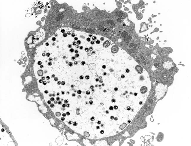 Chlamydia trachomatisの電子顕微鏡写真